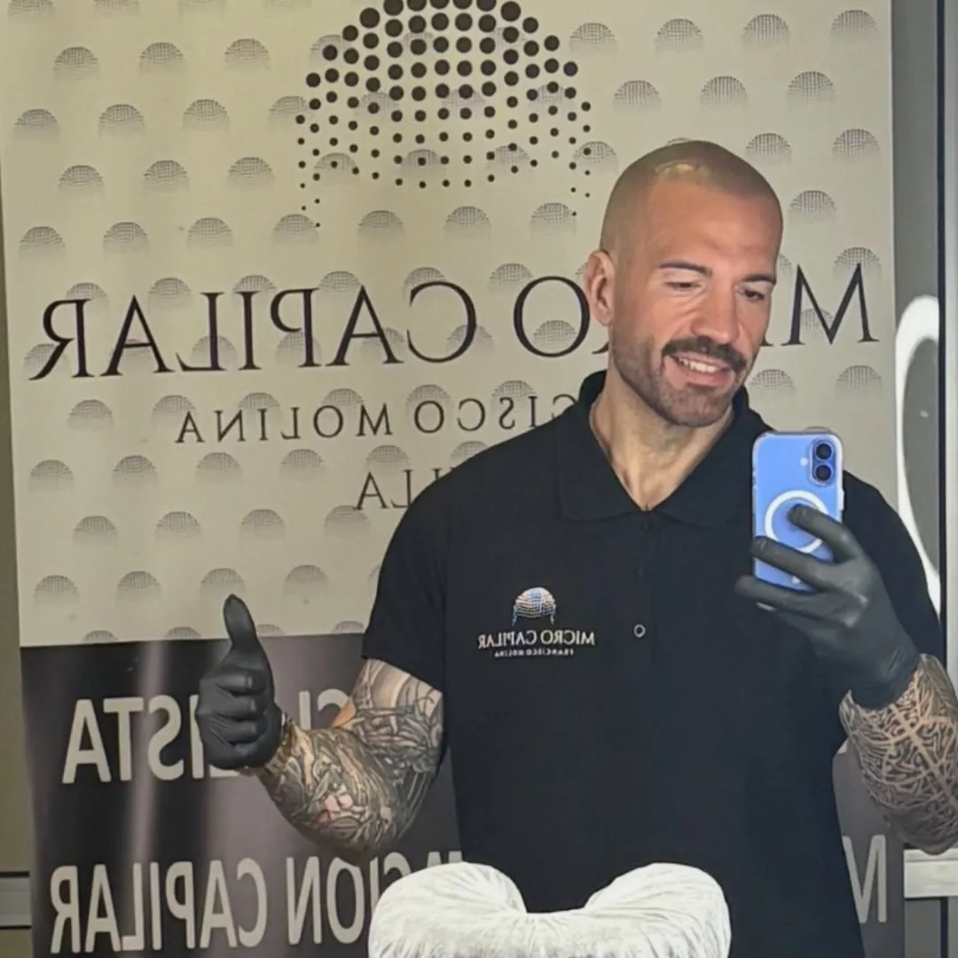 Francisco Molina micropigmentación capilar